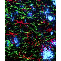 Cortical tissue with plaques stained in blue, and astrocytes responding to drug treatment in red.