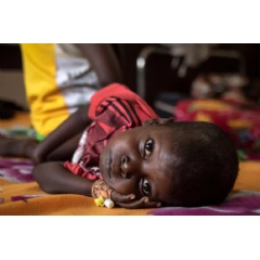 UNICEF/UNI451574/LeMoyne
A child rests on a bed in the nutrition clinic at Lhpital de Bossangoa in Bossangoa, Central African Republic.