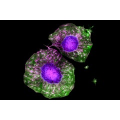 Caption:In response to biochemical and physical cues of exercise, motor neurons (in purple) exhibit new growth (in green) faster than neurons that experience no exercise-induced cues.
Credits:Credit: Angel Bu