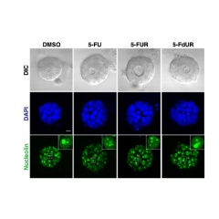 In these images, tumors that clinically benefit from 5-fluorouracil (5-FU) treatments are shown responding to its RNA-damaging effects.
Credits:
Image: Courtesy of the researchers