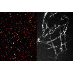 Thanks to a new technique that allows them to expand tissue 20-fold before imaging it, MIT researchers used a conventional light microscope to generate high-resolution images of synapses (L) and microtubules (R)
Credit: Courtesy of the researchers