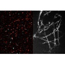 A new method makes high-resolution imaging more accessible